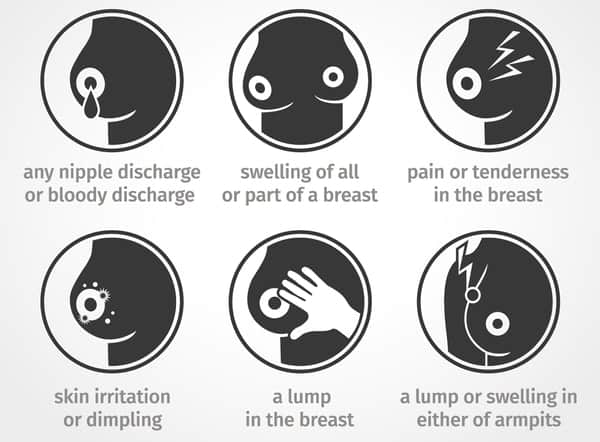 Symptoms of breast cancer