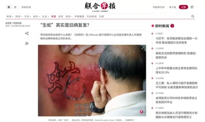 生蛇”其实是旧病复发？