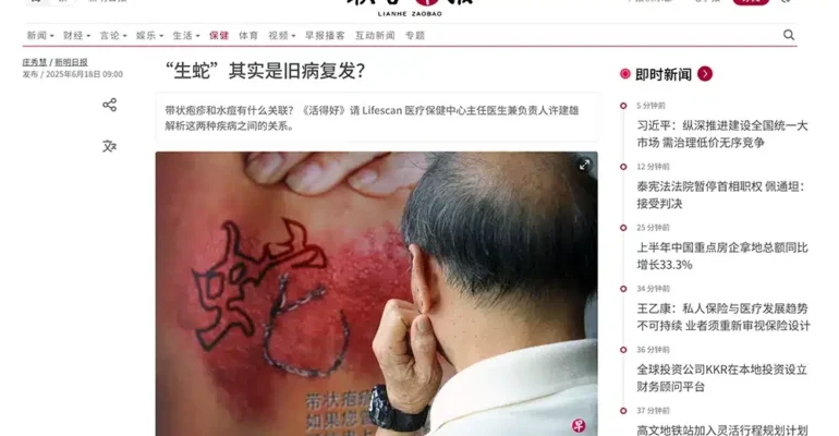 生蛇”其实是旧病复发？